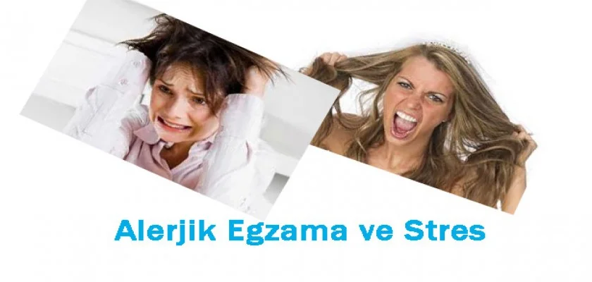 Alerjik Egzamanın Sebebi Stres