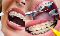 Düzce Ortodonti Doktorları Neden Tercih Edilmelidir?