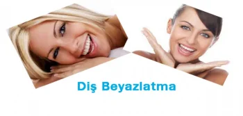 Dişleriniz Beyazlasın