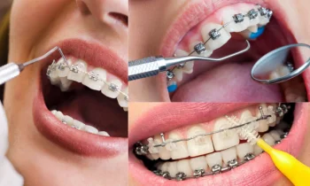 Düzce Ortodonti Doktorları Neden Tercih Edilmelidir?