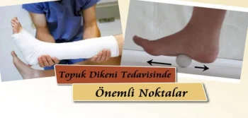 Topuk Dikeni Tedavisinde Önemli Noktalar