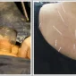 Sülük Hastalıkları Nasıl İyileştirir?