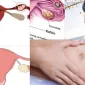 Dış Gebelik Nedir Belirtileri Nelerdir?